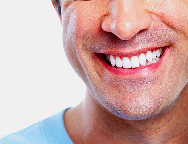 Hollywood Smile – Le secret d’un sourire parfait à la clinique dentaire Revival